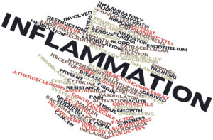 info graphic the word inflammation being described in many words  on a white background