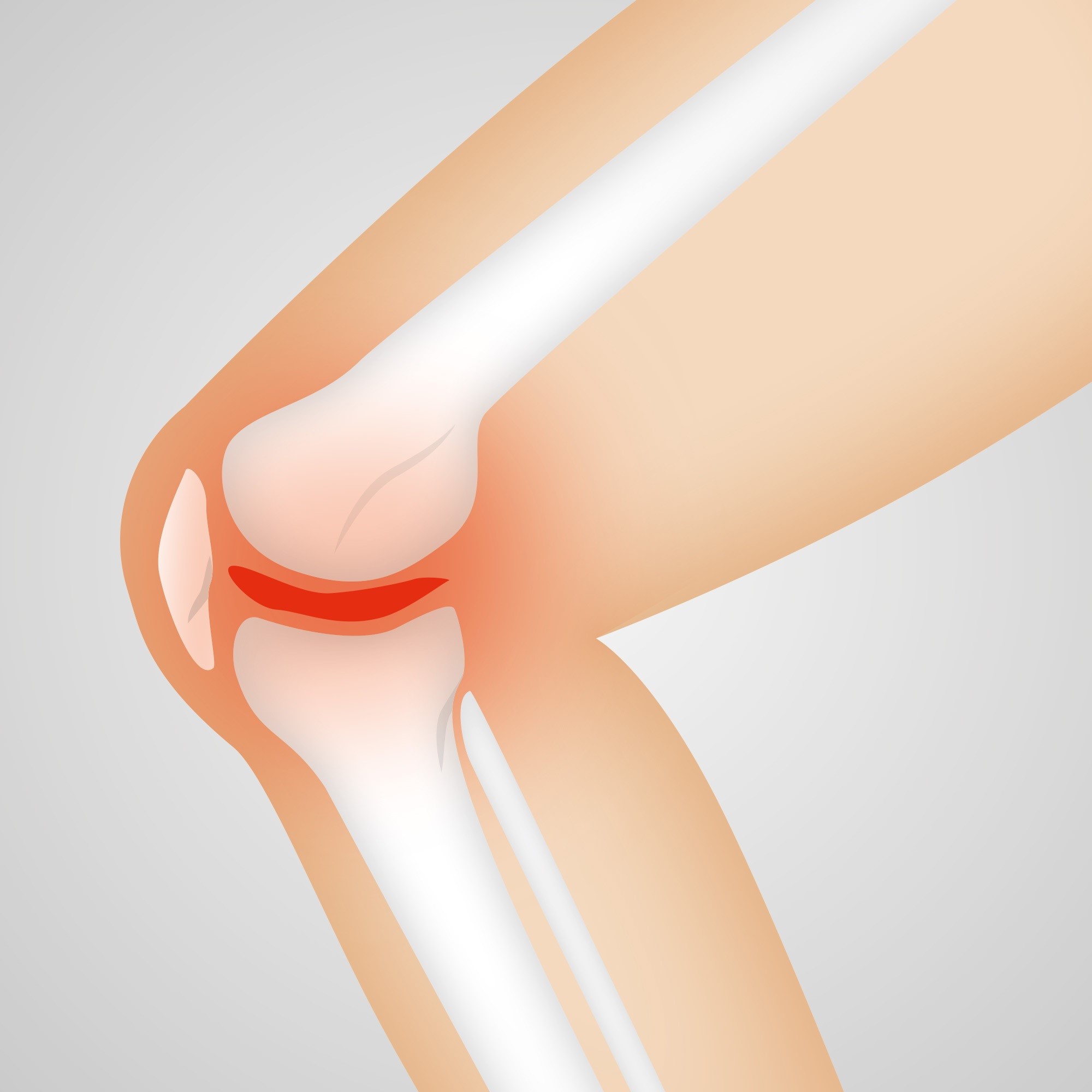 inlamed knee